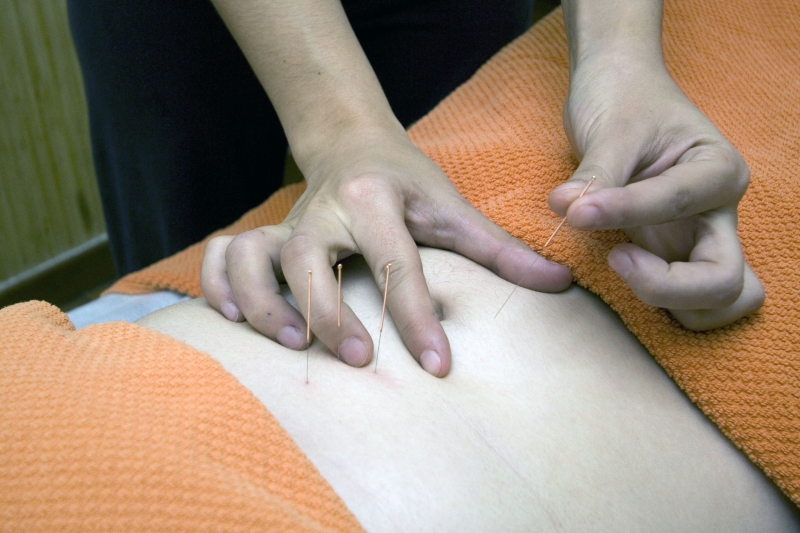 osteopathe-TOURRETTES-min_acupuncture-4175625